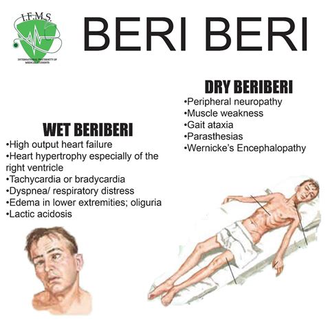 beriberi pictures|Beriberi Photos and Premium High Res Pictures .